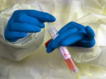 Hejmara mirîyan bi sedema Korona di rojekê de ji 1284 kesan gehişte 1651 kes